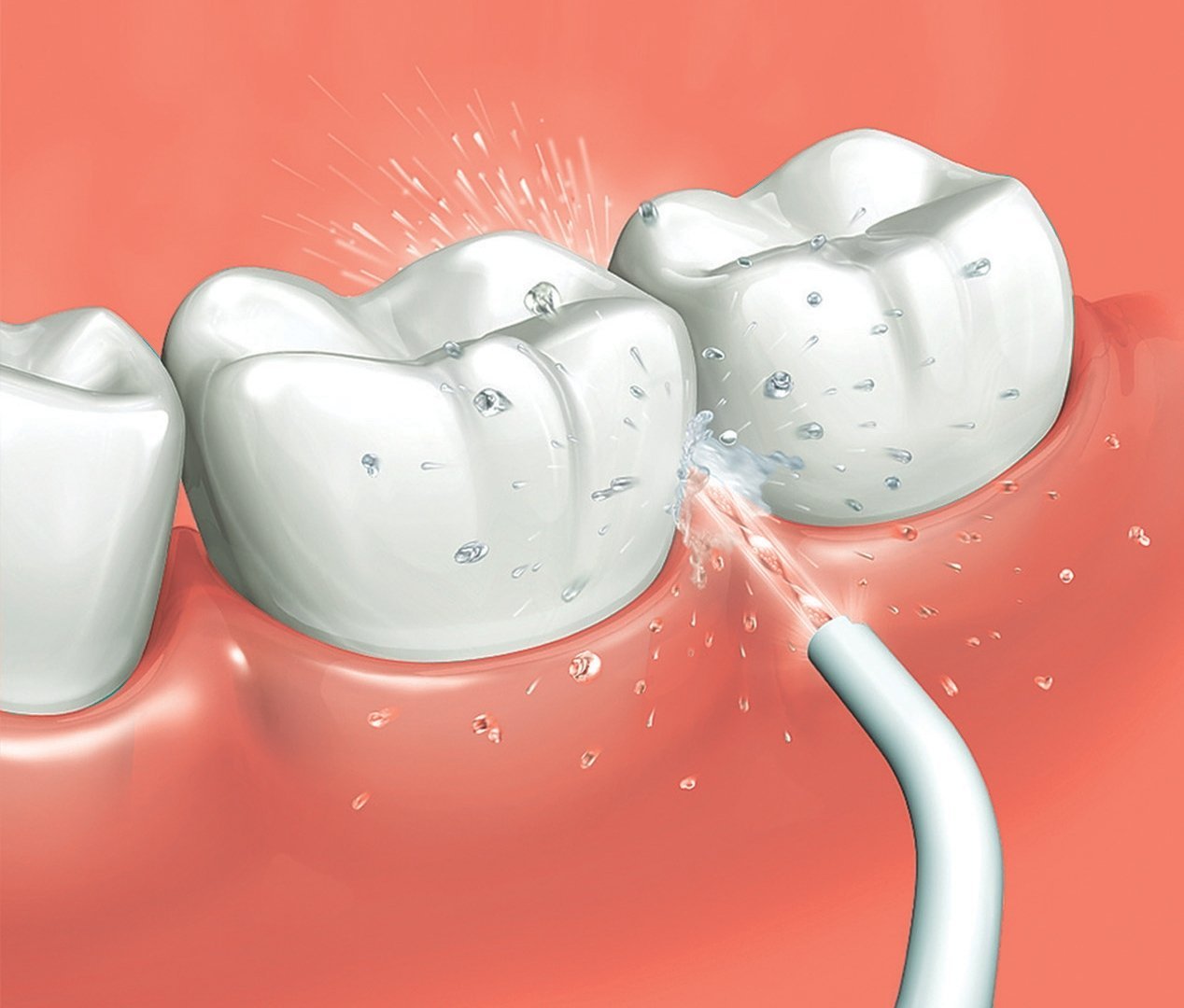 SONRISA RELUCIENTE - LIMPIADOR DENTAL PORTÁTIL